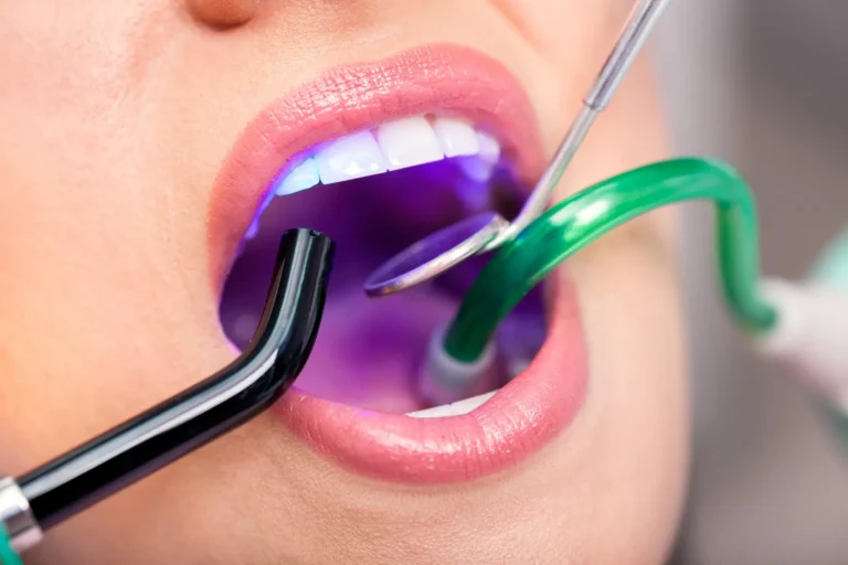 The Evolution of Dentistry: Exploring the Benefits of Laser Dentistry